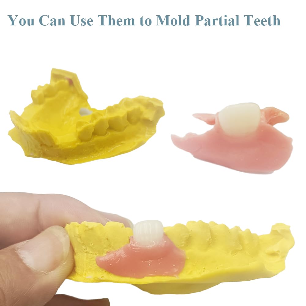 DIY Denture Complete Kit with Impression Material, Gum Material, Components for Top and Bottom Full or Partial Dentures R406238